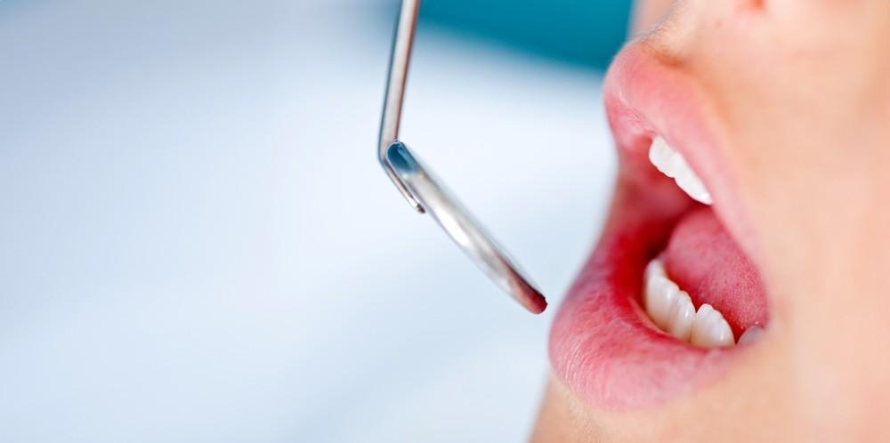 Dental Emergencies